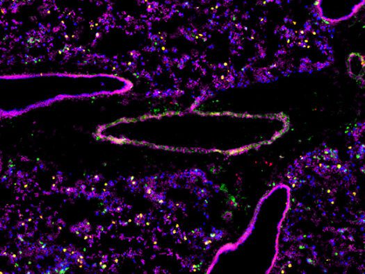 Franklin lab_lung cells HMS Blavatnik Institute Eary Career Investigator Awards