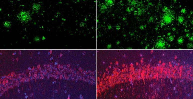 Lithium-Deficiency-vs.-Normal-Lithium-Levels-777×398